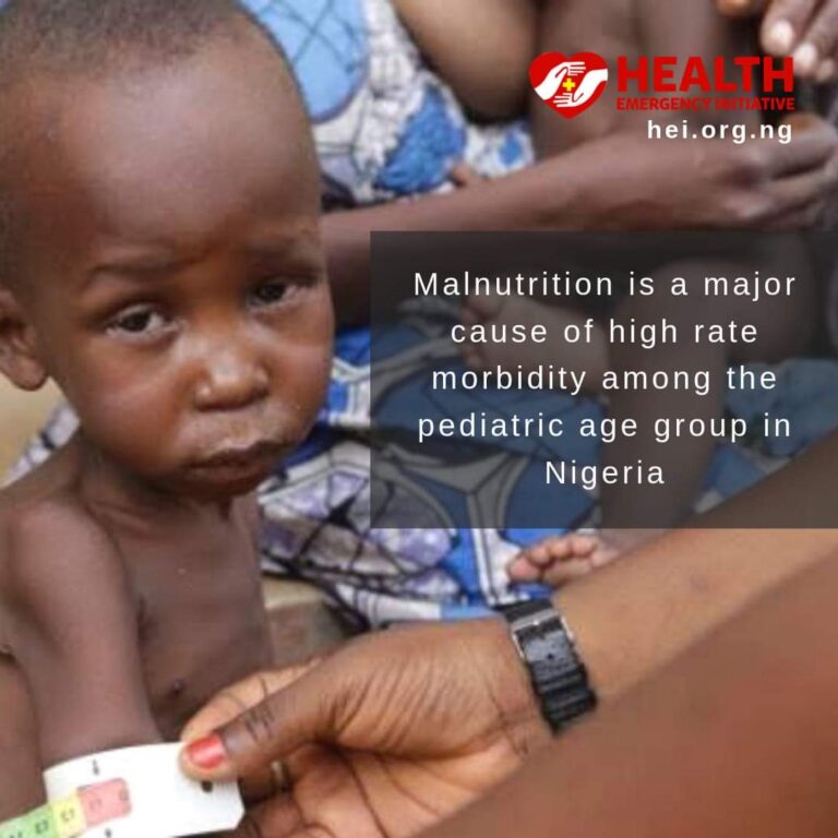 Malnutrition is a Major Cause of High Morbidity Among the Pediatric Age Group in Nigeria.