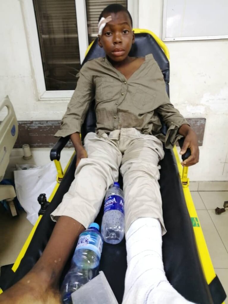 Hit & Run – A boy knocked down by a driver is yet to locate his parent