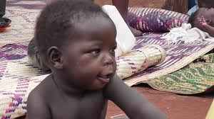 HEI SAVES CHILD FROM HERNIA