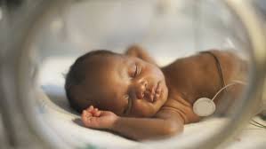 THE INNOCENT BABY STRUGGLES FOR SURVIVAL