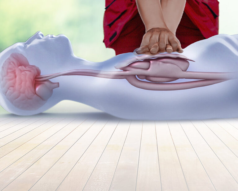 CPR, the Necessary Lifesaving Skill