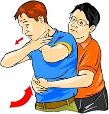 HOW TO HELP A CHOKING PERSON