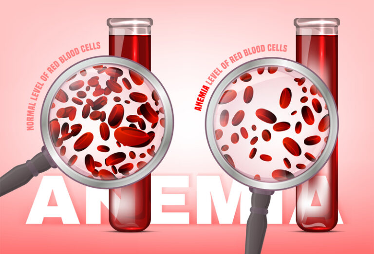 Anaemic Patient Receives   Medical Intervention