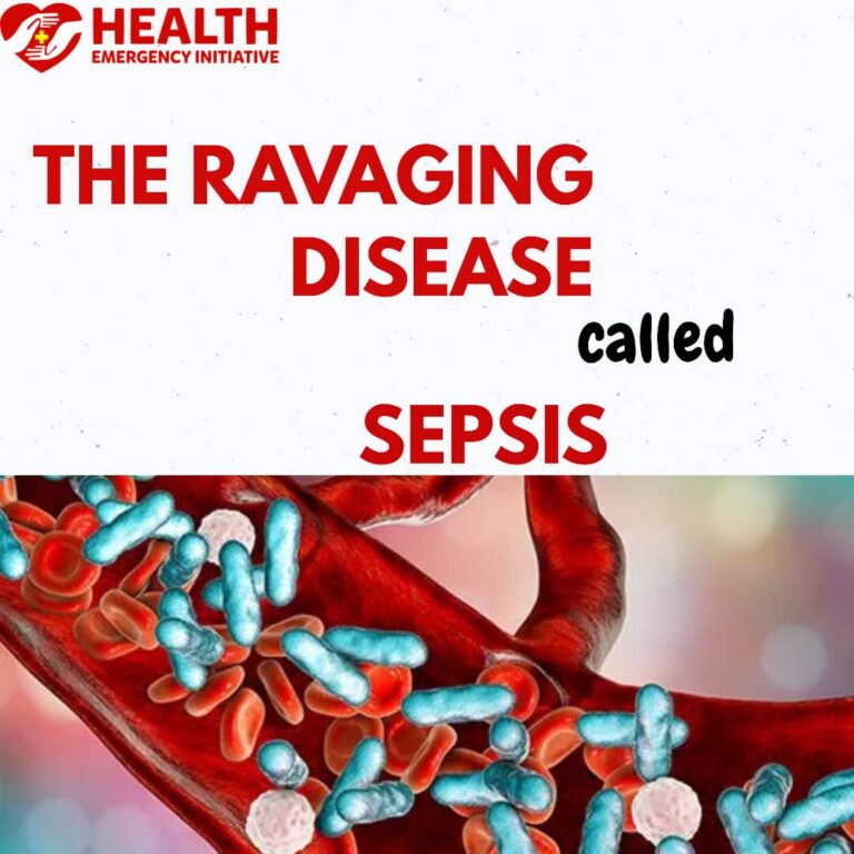 The Ravaging Disease Called ‘Sepsis’ II