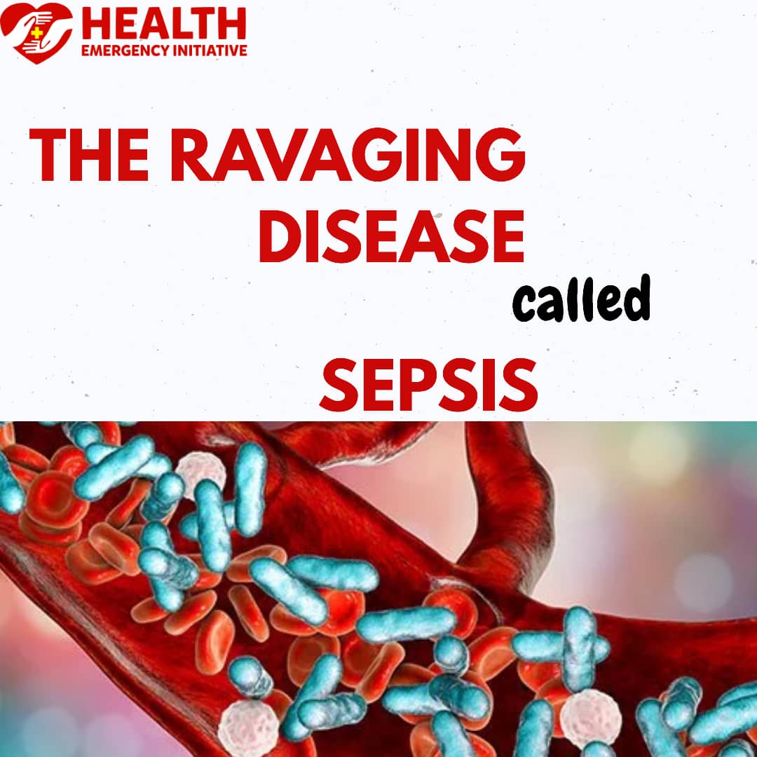 The Ravaging Disease Called ‘Sepsis’ II
