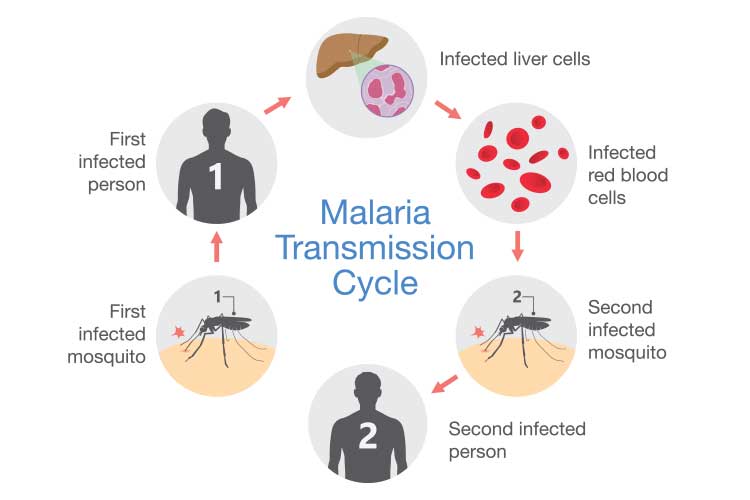The Progression of Malaria into Cerebral Malaria